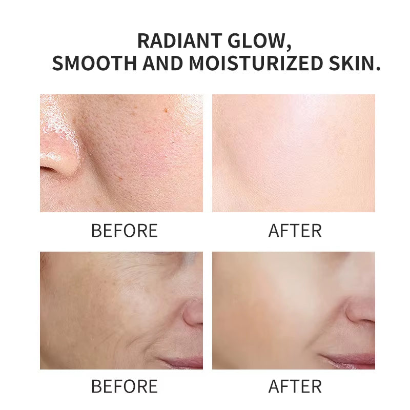 Hot Selling 30Ml Organic Facial Skin Care Turmeric Vitamin C Collagen Kojic Acid Snail Face Serum